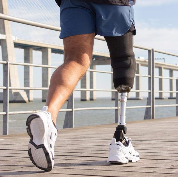 Custom-Prosthetics-and-Medical-Devices
